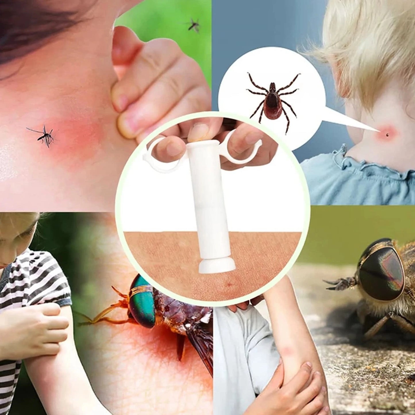 Suction Tool For Bug Bites And Bee Wasp Sting Relief Venom Extractor Hiking