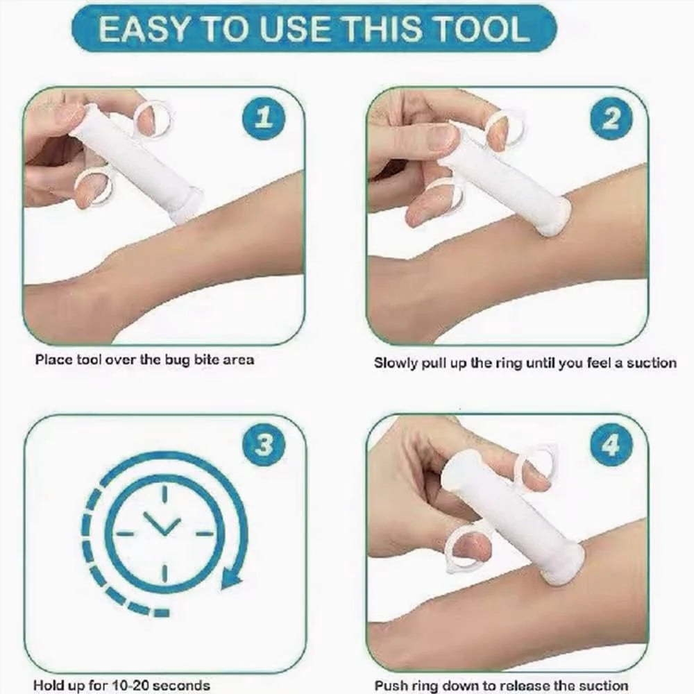 Suction Tool For Bug Bites And Bee Wasp Sting Relief Venom Extractor Hiking